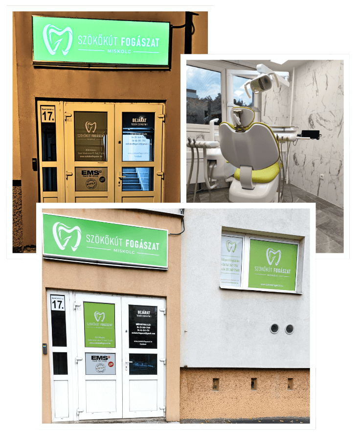 Szökőkút Fogászat és Prevenciós Műhely Miskolc